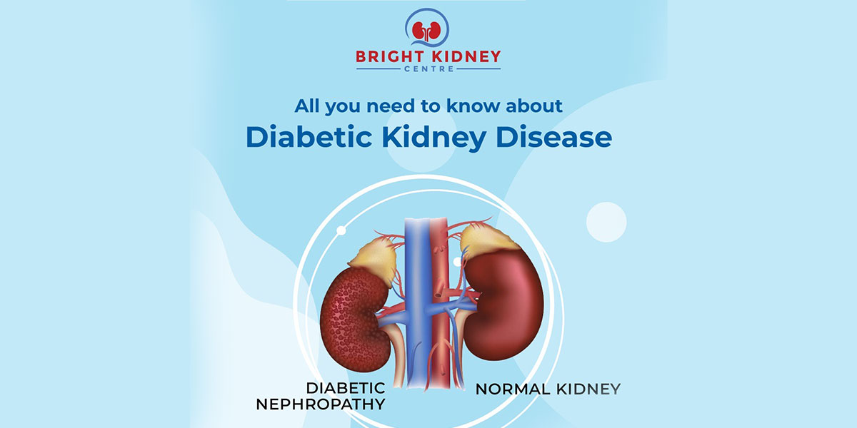 All you need to know about Diabetic Kidney Disease
