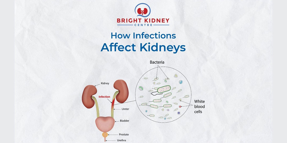 How infections affect kidneys