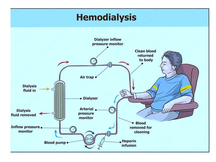 things to do when on dialysis