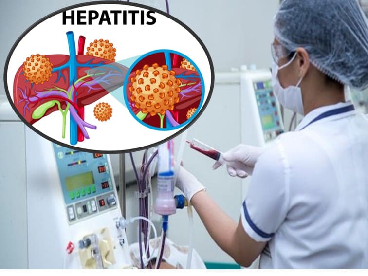 hepatitis-c-and-hemodialysis