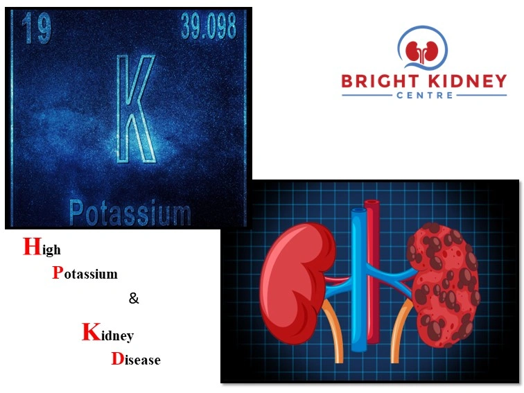 high potassium and kidney disease